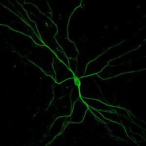 Benefits of dPGA as a cell culture substrate coating