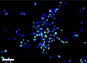 Generation of human iPSC-derived phrenic-like motor neurons to model respiratory motor neuron degeneration in ALS