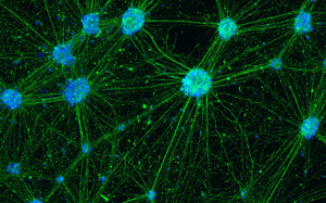 The possible causes of cells dying in cell culture
