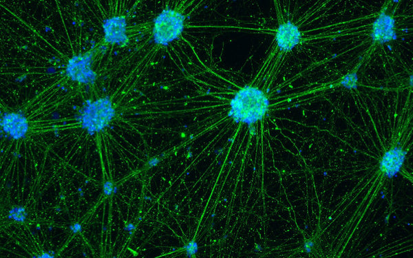 The possible causes of cells dying in cell culture