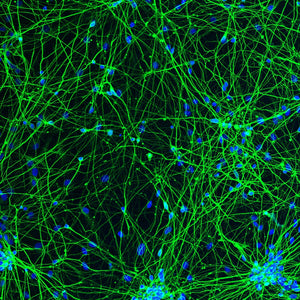 Dendritic Polyglycerol Amine: An Enhanced Substrate to Support Long-Term Neural Cell Culture