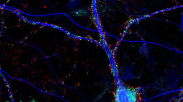 Tips for Keeping Primary Neuron Cultures Healthy